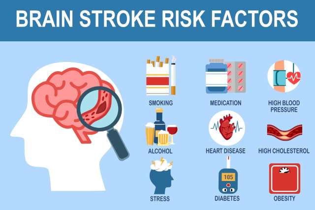 Identifying Stroke Risk Factors and Taking Preventive Actions