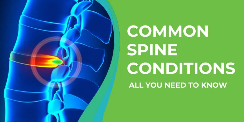 Understanding Common Spine Conditions