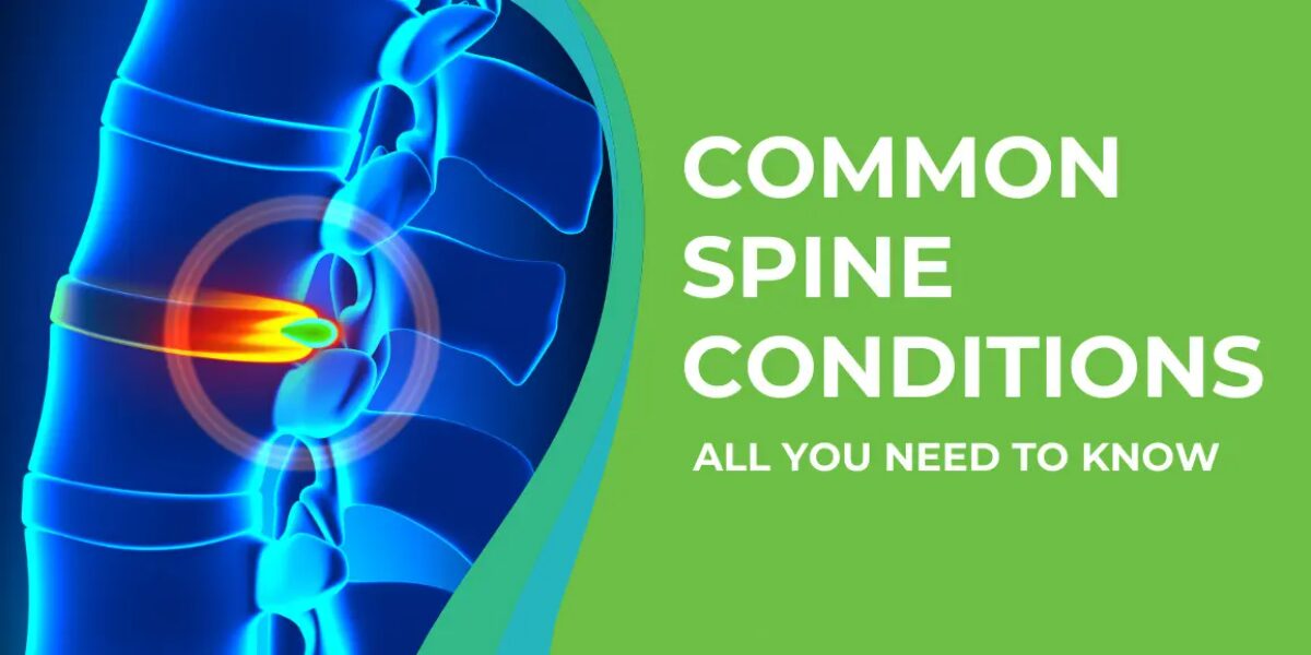 Understanding Common Spine Conditions | Dr. Sachin Mahajan