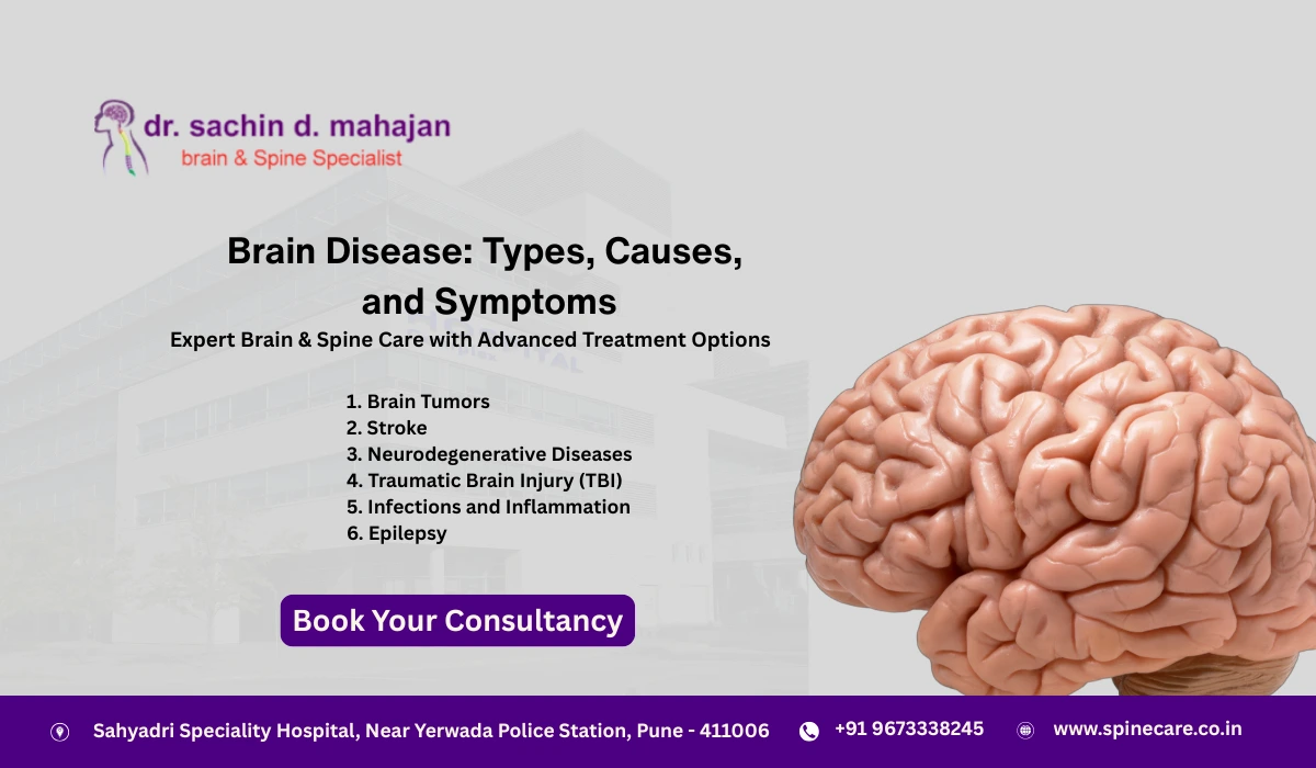 Brain Disease Types, Causes, and Symptoms